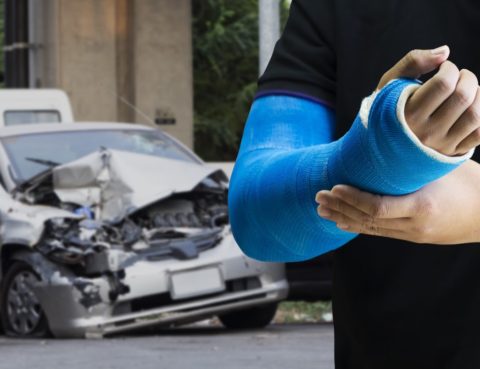 Man holding his arm in a cast after a car accident